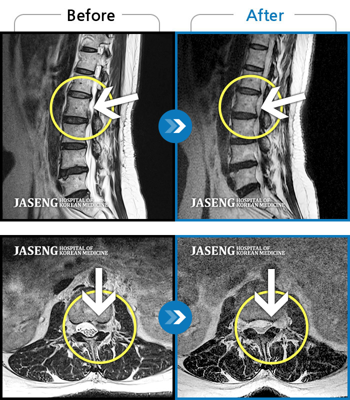 ϻڻѹ溴 ġ MRI  ġ-ó   㸮    ,  ٸ   ϰ ־  Ȱ , ߰ ᵵ  ڰ  Ͽ  Ȱ  ¼̽ϴ. 