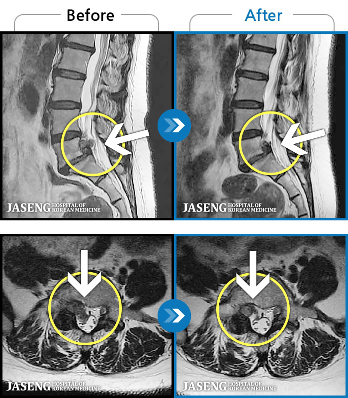 �ڻ��ѹ溴�� ġ���� MRI�� ���� ġ����-���� ��ġ���� �����ƻ� ������ ������ ���� �ȵ���.