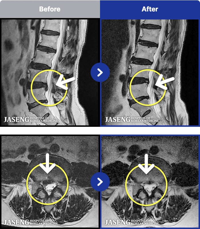 �ڻ��ѹ溴�� ġ���� MRI�� ���� ġ����-�ؽ��� ���� �� ������������� ������ ����� �ϻ��Ȱ�� �Ұ����� ���·� �����ϼ̽��ϴ�.