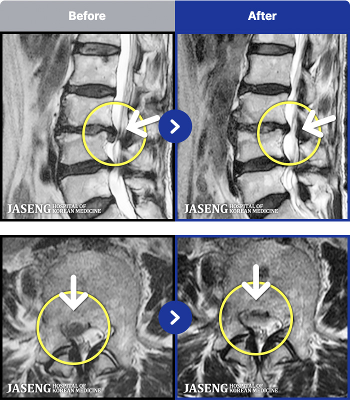 �ڻ��ѹ溴�� ġ���� MRI�� ���� ġ����-�ϻ��Ȱ �� �߻��� �㸮 ������ ���� �ٸ� ���� ����