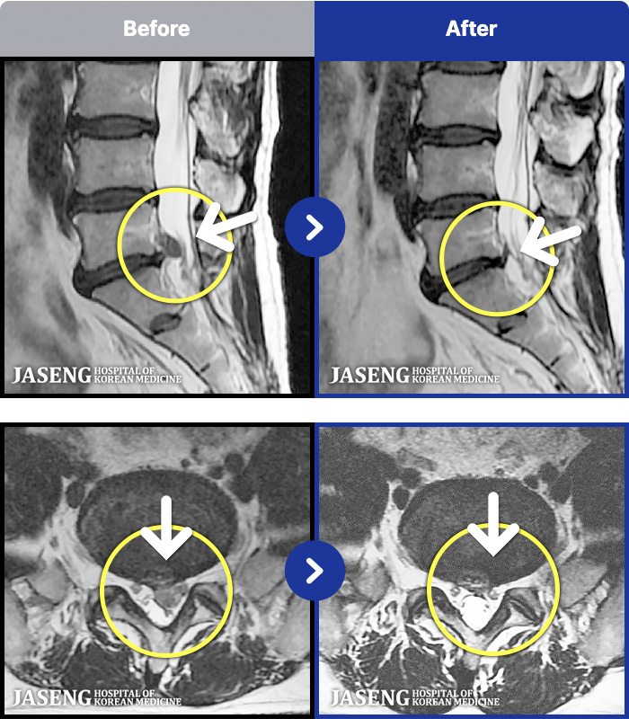 Ȼڻѹ溴 ġ MRI ġ-㸮 Բ ٸ ȱⰡ .