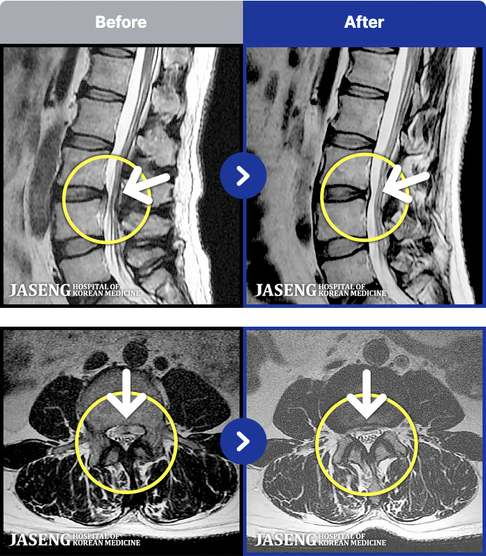 �ڻ��ѹ溴�� ġ���� MRI�� ���� ġ����-���� ��ݺ��� �ٸ������� ������ ���������� �ȱⰡ �����.