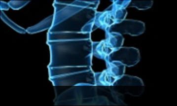 잠실자생한방병원 허리질환 척추전방전위증-정상적인 사람의 척추뼈 모습입니다.