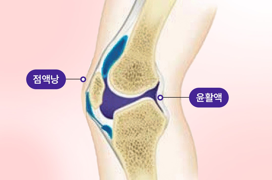 무릎 관절 주변 점액낭과 윤활액 부위를 표시한 일러스트