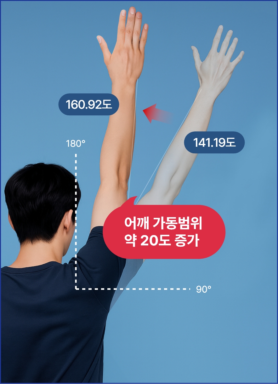 어깨 외회전 가동범위가 치료 후 약 20도 증가한 모습을 보여주는 팔 들기 비교 이미지